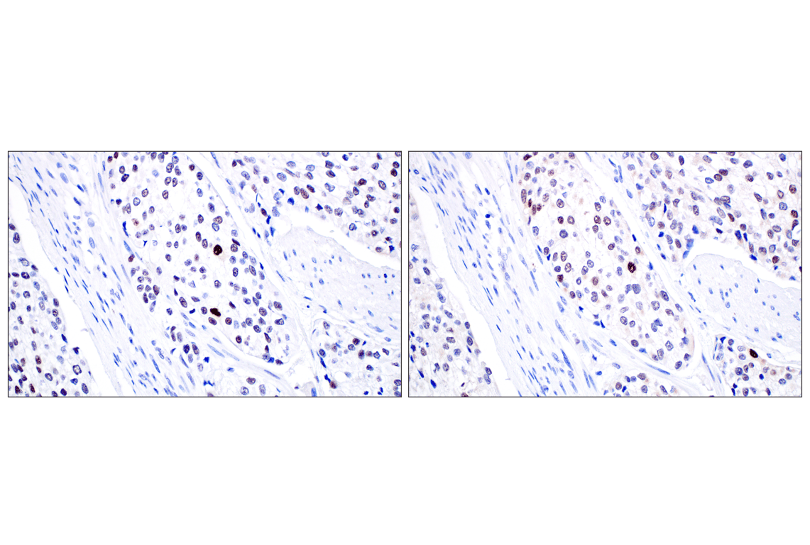 Immunohistochemistry Image 8: MDM2 (F7W7X) Rabbit mAb