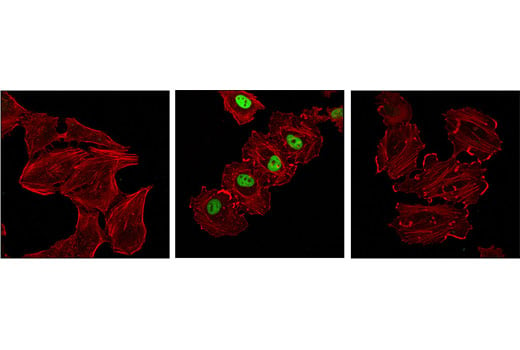 Immunofluorescence Image 1: Phospho-c-Fos (Ser32) (D82C12) XP<sup>®</sup> Rabbit mAb (BSA and Azide Free)