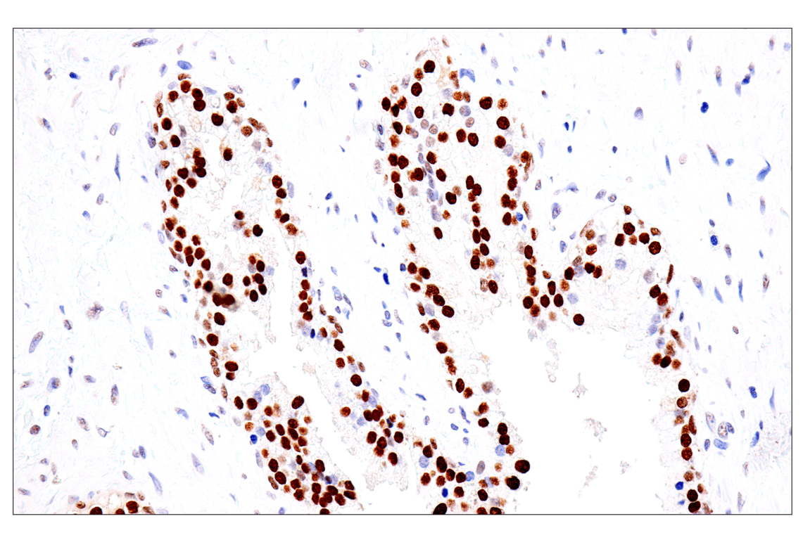 Immunohistochemistry Image 4: FoxA1/HNF3α (IHC578) Mouse mAb
