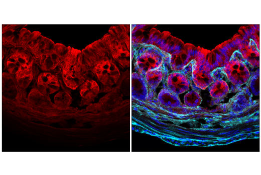 Immunofluorescence Image 1: Galectin-3/LGALS3 (E7B6R) Rabbit mAb