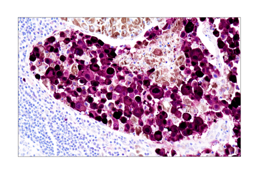 Immunohistochemistry Image 3: S100A1 (4C4.9) Mouse mAb
