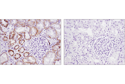 Immunohistochemistry Image 3: Cadherin-6 (D3T3I) Rabbit mAb
