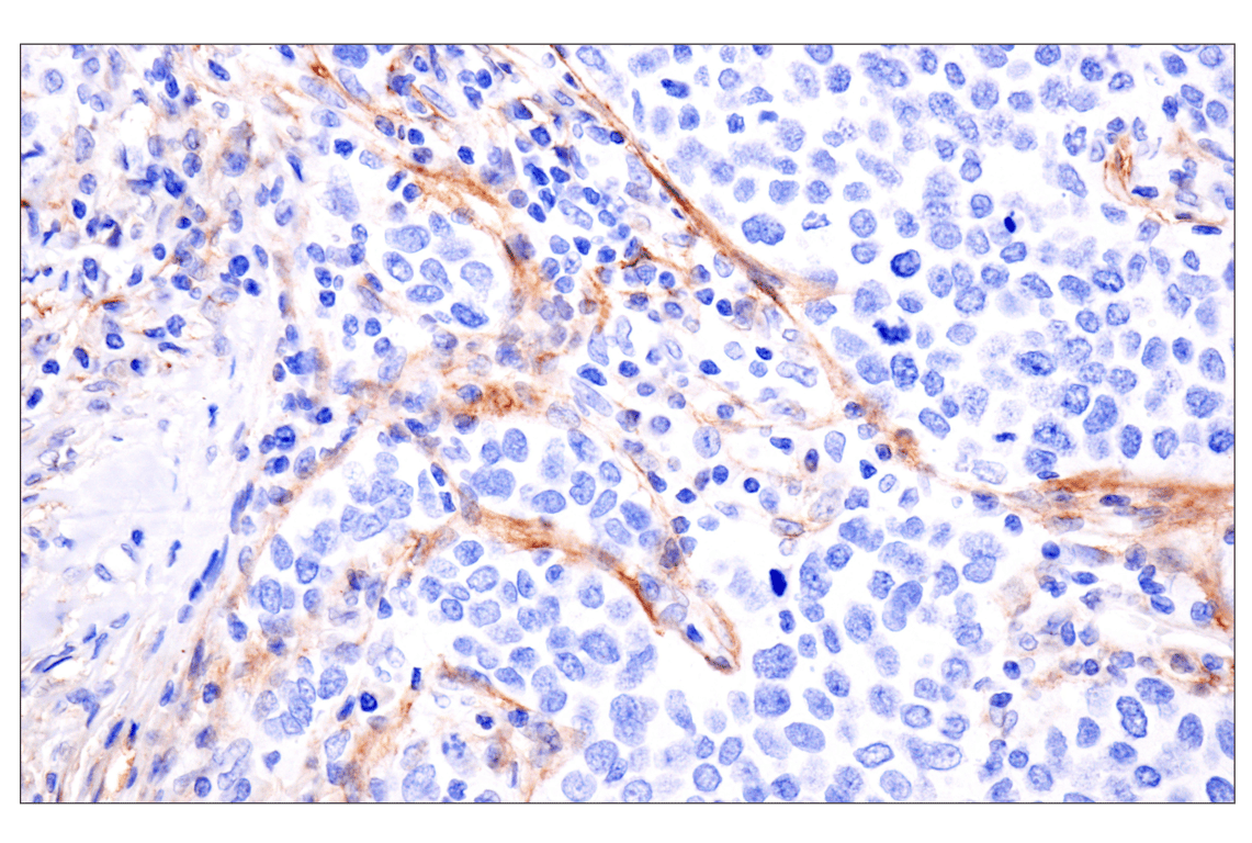 Immunohistochemistry Image 2: LRRC15 (E4X8J) Rabbit mAb