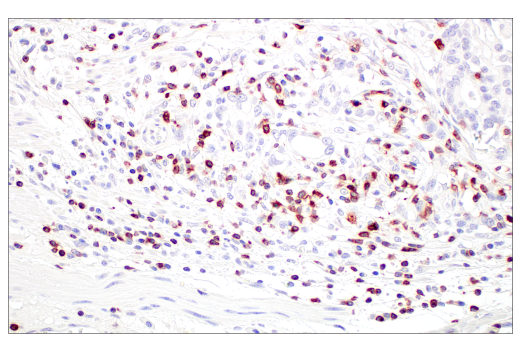 Immunohistochemistry Image 5: CD7 (E4G1Q) XP<sup>®</sup> Rabbit mAb