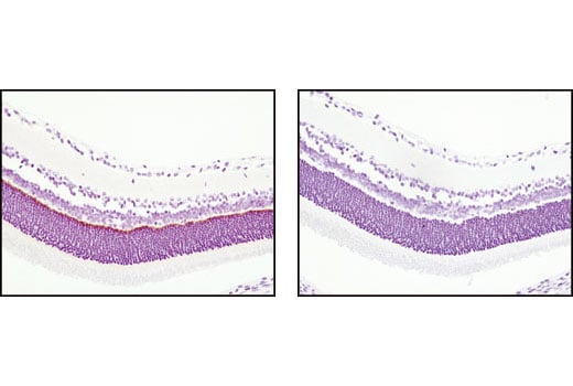 Immunohistochemistry Image 1: PSD95 (D74D3) XP<sup>®</sup> Rabbit mAb (BSA and Azide Free)
