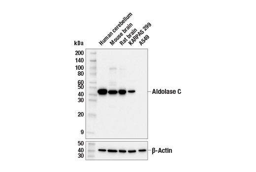 Western Blotting Image 2: Aldolase C (E7T4G) Mouse mAb