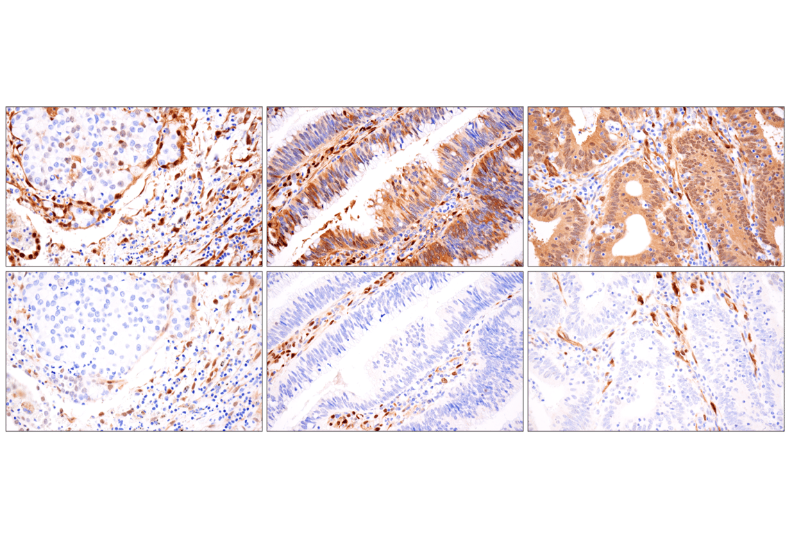 Immunohistochemistry Image 4: YAP (D8H1X) XP<sup>®</sup> Rabbit mAb