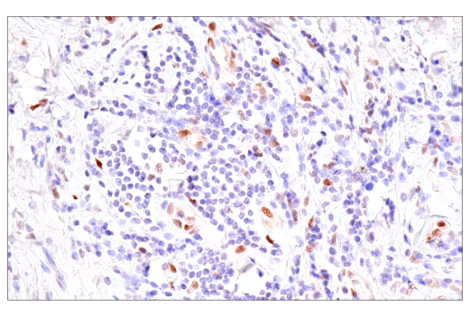 Immunohistochemistry Image 2: Bcl-3 (E4D4K) Rabbit mAb