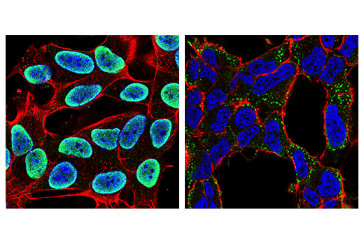 Immunofluorescence Image 1: FUS/TLS (E3O8I) Rabbit mAb (BSA and Azide Free)