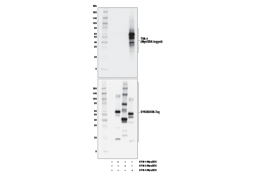 Western Blotting Image 1: TIM-4 (D3W4F) XP<sup>®</sup> Rabbit mAb