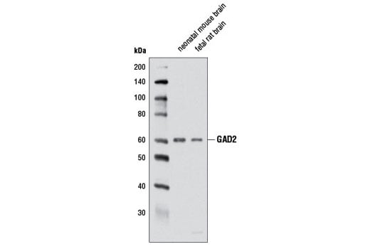 Western Blotting Image 1: GAD2 (D5G2) XP<sup>®</sup> Rabbit mAb