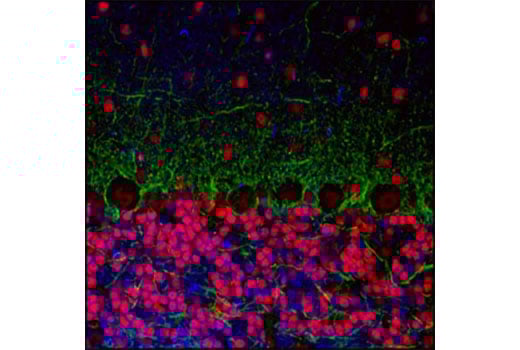 undefined Image 74: Cannabinoid Receptor 1 Downstream Signaling Antibody Sampler Kit
