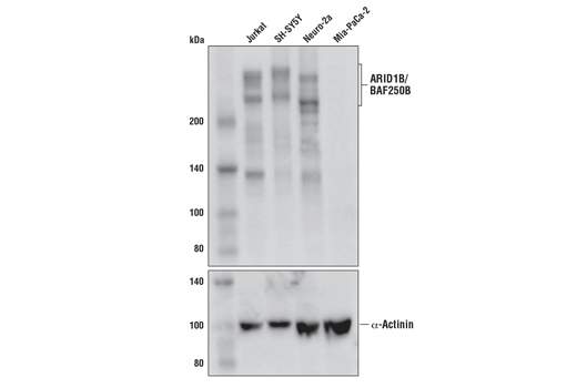 undefined Image 8: BAF Complex IHC Antibody Sampler Kit