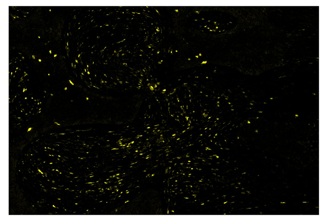 Immunohistochemistry Image 3: Tox/Tox2 (E6I3Q) & CO-0016-750 SignalStar<sup>™</sup> Oligo-Antibody Pair