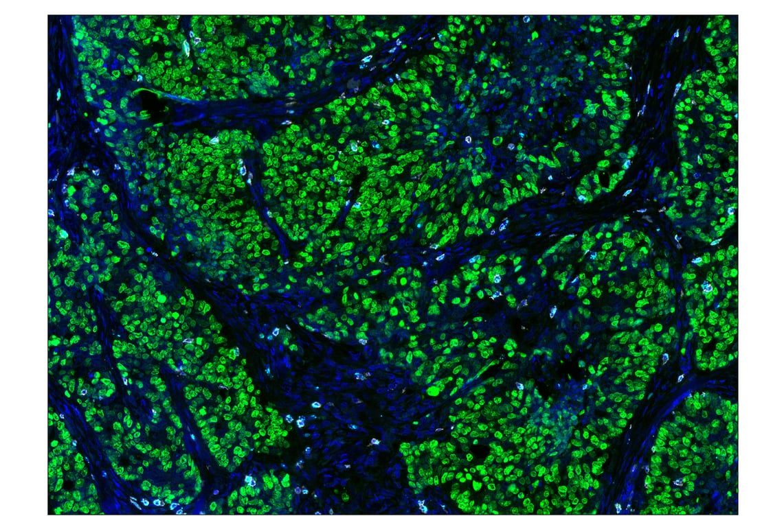 Immunohistochemistry Image 1: Ki-67 (8D5) & CO-0014-647 SignalStar<sup>™</sup> Oligo-Antibody Pair