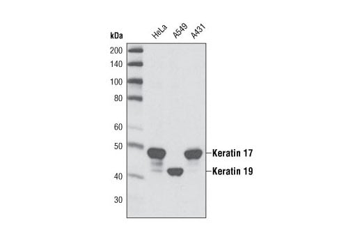 Western Blotting Image 1: Keratin 17/19 (D32D9) XP® Rabbit mAb (BSA and Azide Free)