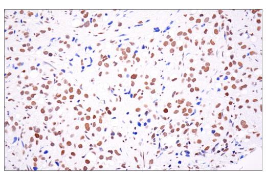 Immunohistochemistry Image 8: ATRX (E5X7O) Rabbit mAb (BSA and Azide Free)