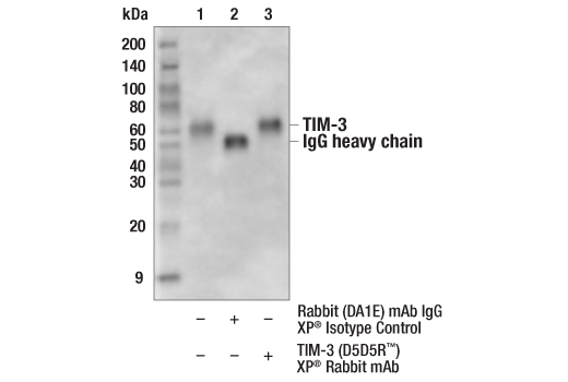 undefined Image 7: Human Exhausted CD8<sup>+</sup> T Cell IHC Antibody Sampler Kit