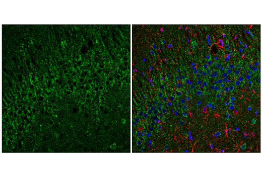 Immunofluorescence Image 3: EEA1 (C45B10) Rabbit mAb