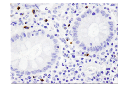 Immunohistochemistry Image 2: LAG3 (D2G4O<sup>™</sup>) XP<sup>®</sup> Rabbit mAb (BSA and Azide Free)