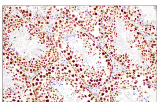 Immunohistochemistry Image 7: Ezh2 (D2C9) XP<sup>®</sup> Rabbit mAb (BSA and Azide Free)