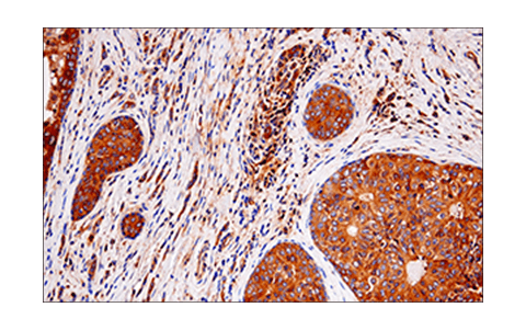 Immunohistochemistry Image 2: RIP (E8S7U) XP<sup>®</sup> Rabbit mAb