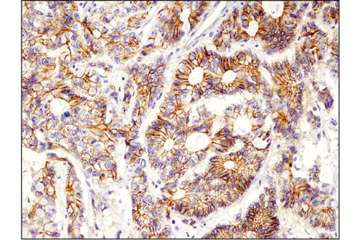 Immunohistochemistry Image 2: Non-phospho (Active) β-Catenin (Ser45) (D2U8Y) XP<sup>®</sup> Rabbit mAb (BSA and Azide Free)