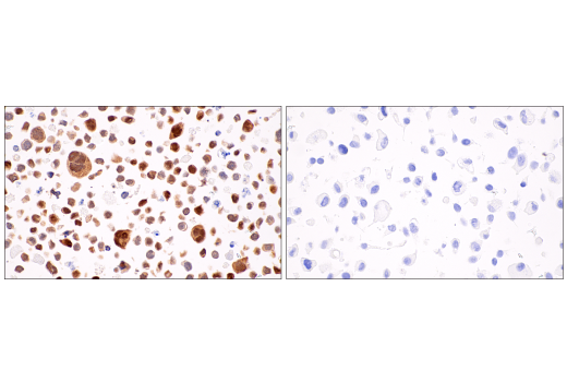 Immunohistochemistry Image 10: Parvalbumin (E8N2U) XP<sup>®</sup> Rabbit mAb