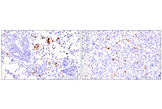Immunohistochemistry Image 3: ICOS (E5F7E) Rabbit mAb (BSA and Azide Free)