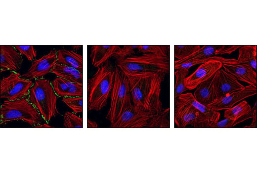 Immunofluorescence Image 1: Phospho-β-Catenin (Ser675) (D2F1) XP<sup>®</sup> Rabbit mAb (BSA and Azide Free)