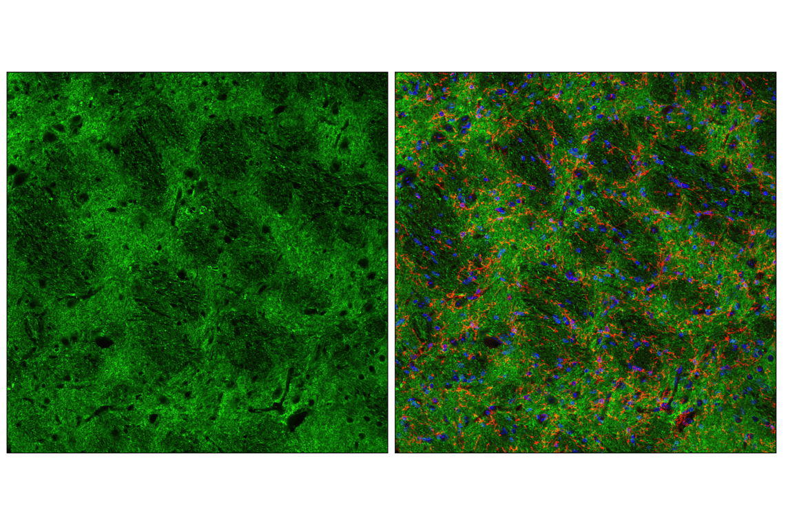 undefined Image 42: LRP1-mediated Endocytosis and Transmission of Tau Antibody Sampler Kit