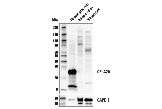 Western Blotting Image 1: CELA2A (E1D6G) Rabbit mAb