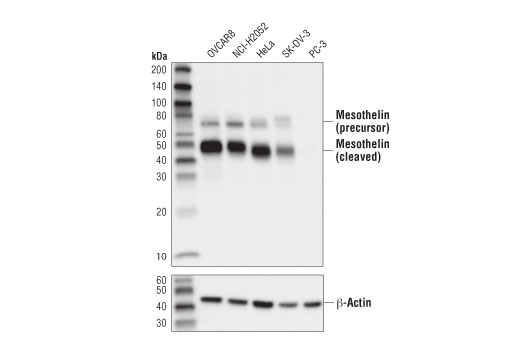 Western Blotting Image 1: Mesothelin (D9R5G) XP<sup>®</sup> Rabbit mAb (BSA and Azide Free)