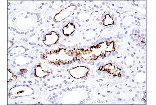 Immunohistochemistry Image 3: CD133 (D4W4N) XP<sup>®</sup> Rabbit mAb (BSA and Azide Free)