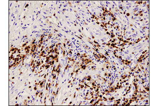 Immunohistochemistry Image 3: CD79A (D1X5C) XP<sup>®</sup> Rabbit mAb (BSA and Azide Free)