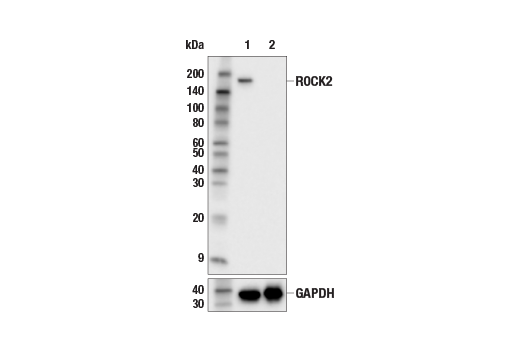 Western Blotting Image 2: ROCK2 (E5T5P) Rabbit mAb