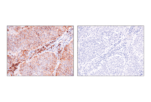 undefined Image 23: Glutamine Metabolism Antibody Sampler Kit