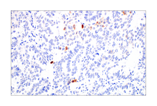 Immunohistochemistry Image 3: CYR61 (E5W3H) Rabbit mAb
