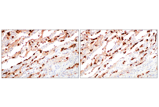 Immunohistochemistry Image 10: LAMP3/CD208 (E6E5U) XP<sup>®</sup> Rabbit mAb (BSA and Azide Free)