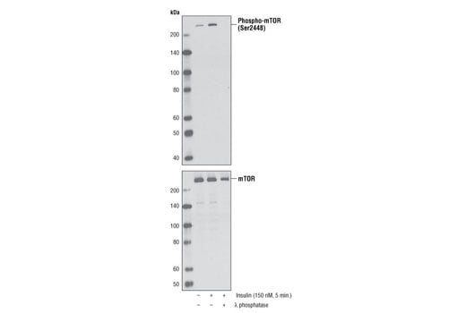undefined Image 6: TREM2-dependent mTOR Metabolic Fitness Antibody Sampler Kit