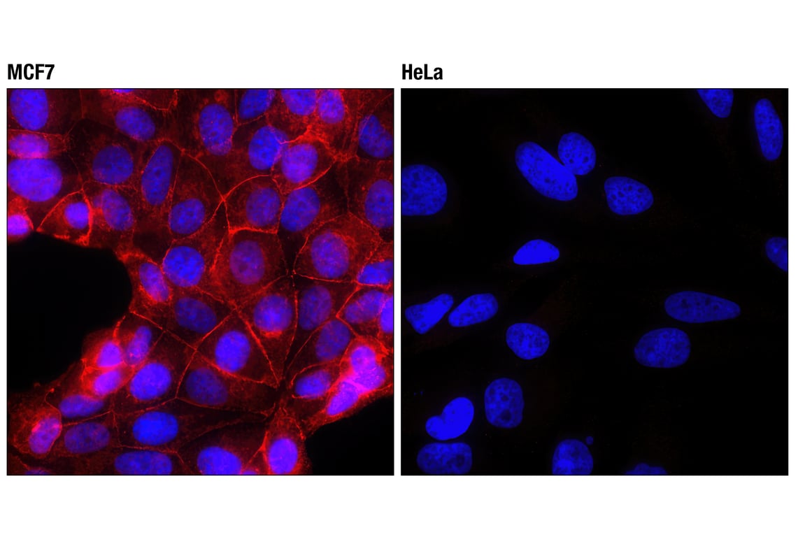 Immunofluorescence Image 1: E-Cadherin (24E10) Rabbit mAb (Alexa Fluor<sup>®</sup> 594 Conjugate)