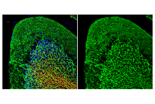 Immunofluorescence Image 1: AQP4 (D1F8E) XP<sup>®</sup> Rabbit mAb (Alexa Fluor<sup>®</sup> 488 Conjugate)