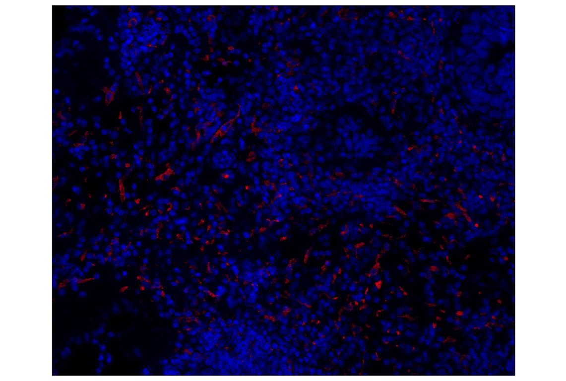 Immunohistochemistry Image 1: CD163 (D6U1J) Rabbit mAb (Alexa Fluor<sup>®</sup> 647 Conjugate)