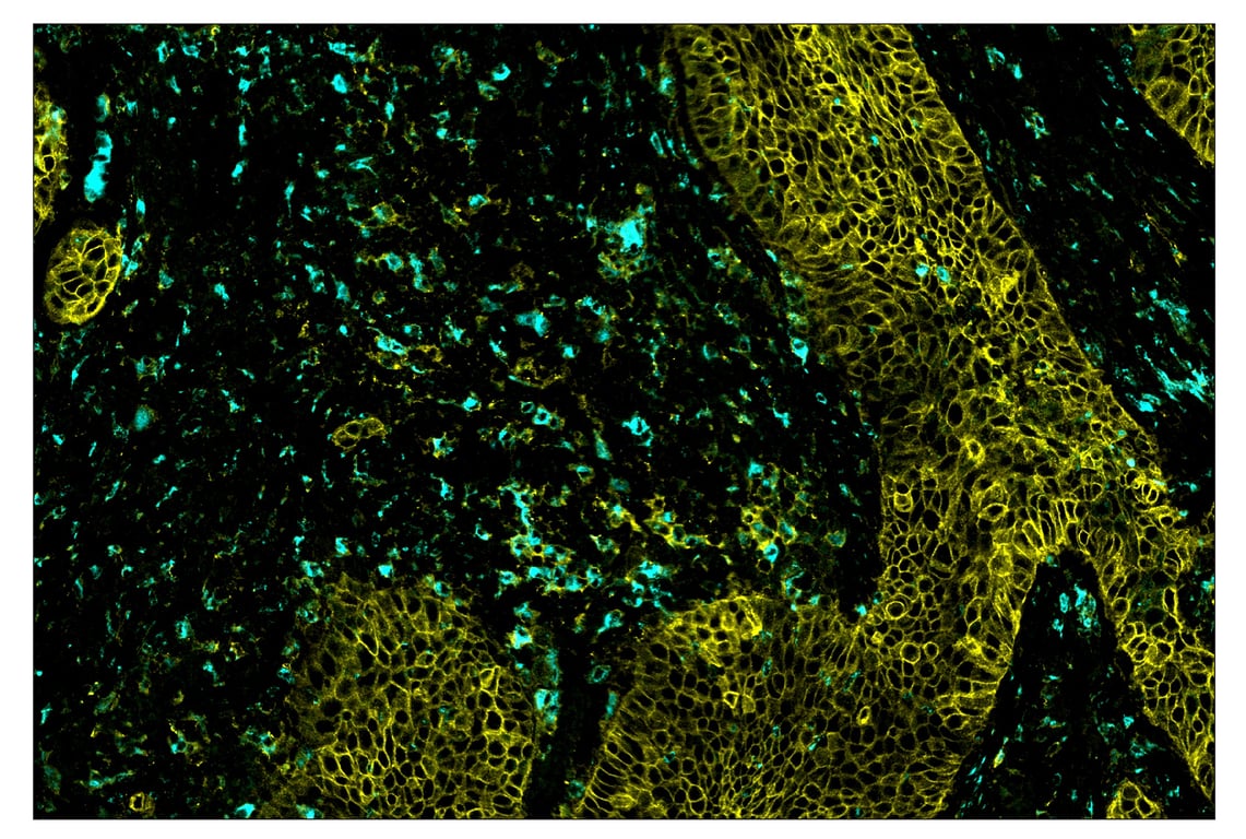 Immunohistochemistry Image 1: CD68 (D4B9C) & CO-0007-594 SignalStar<sup>™</sup> Oligo-Antibody Pair