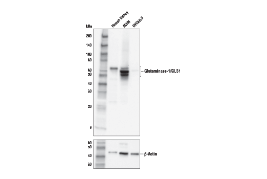 undefined Image 5: Glutamine Metabolism Antibody Sampler Kit