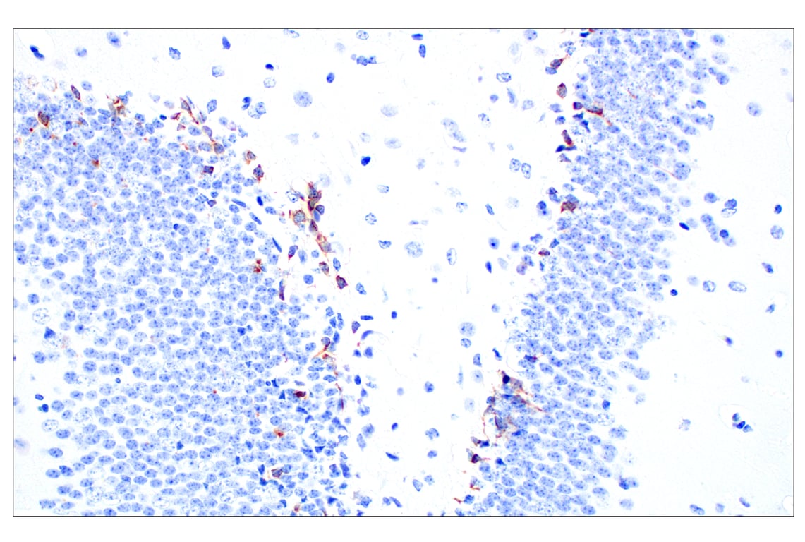 Immunohistochemistry Image 3: Doublecortin (E3S7L) Rabbit mAb (BSA and Azide Free)