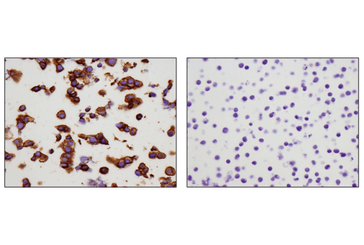 Immunohistochemistry Image 3: c-Kit (D3W6Y) XP<sup>®</sup> Rabbit mAb (BSA and Azide Free)