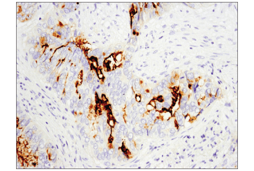 Immunohistochemistry Image 1: CD133 (D4W4N) XP<sup>®</sup> Rabbit mAb