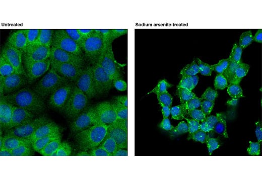 Immunofluorescence Image 1: RSK2 (D21B2) XP<sup>®</sup> Rabbit mAb (BSA and Azide Free)