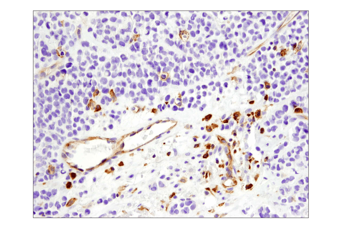 Immunohistochemistry Image 3: VISTA (D1L2G<sup>™</sup>) XP<sup>®</sup> Rabbit mAb